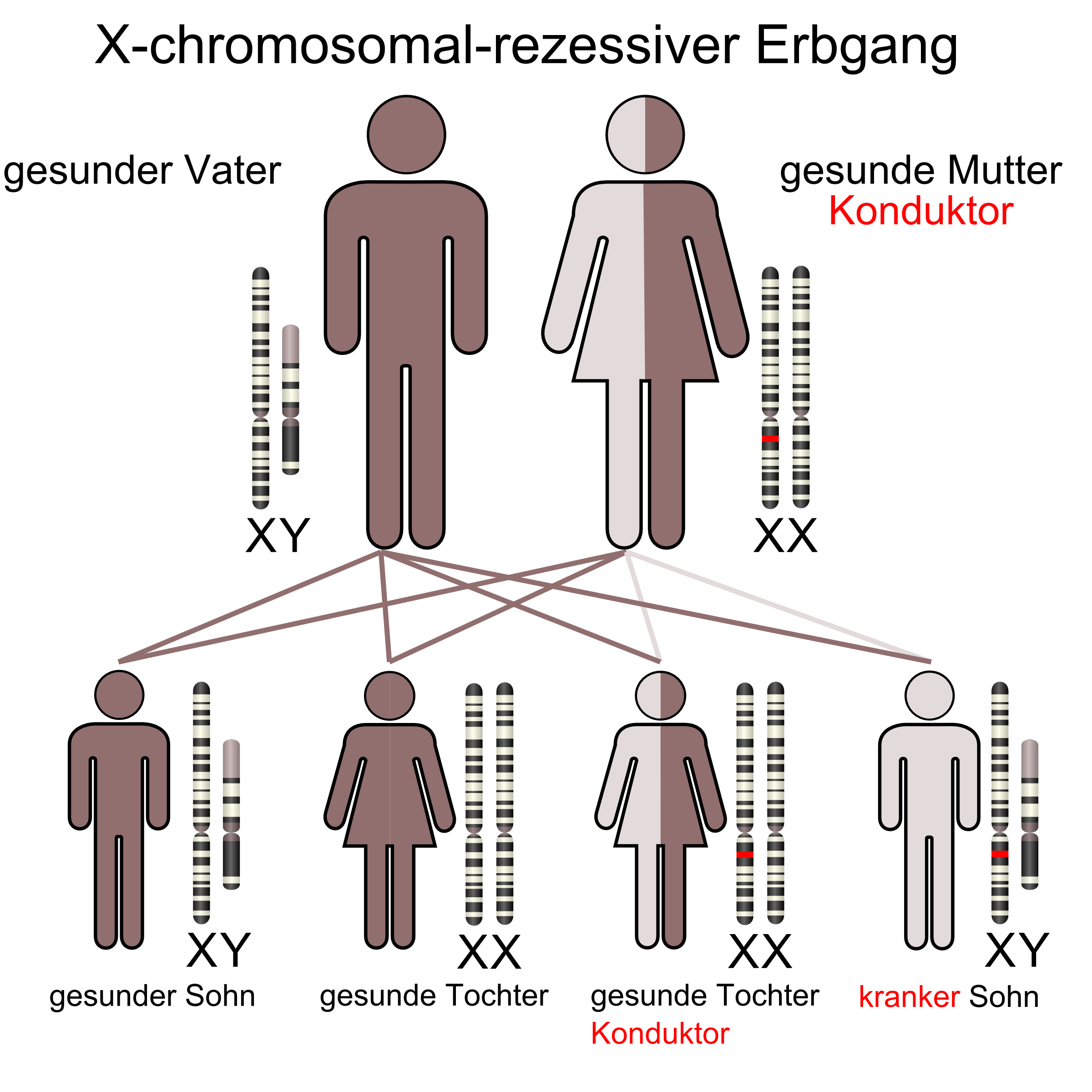 X-chromosomal-rezessive Vererbung